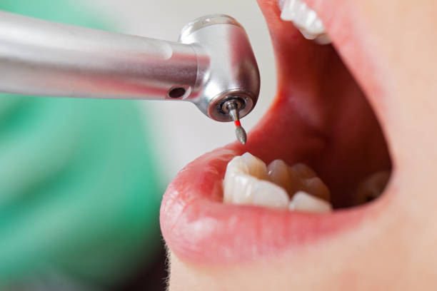 Best Dental Abscess Treatment in Muskegon, MI